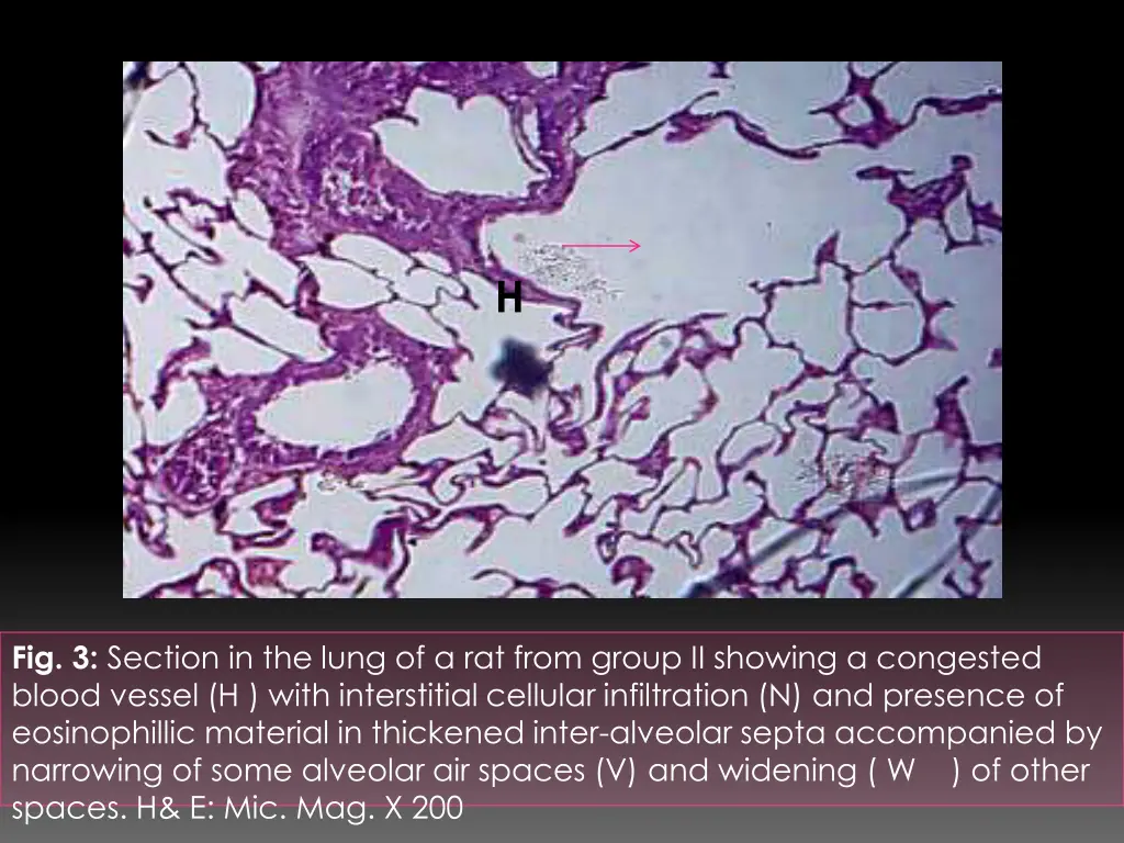 slide18