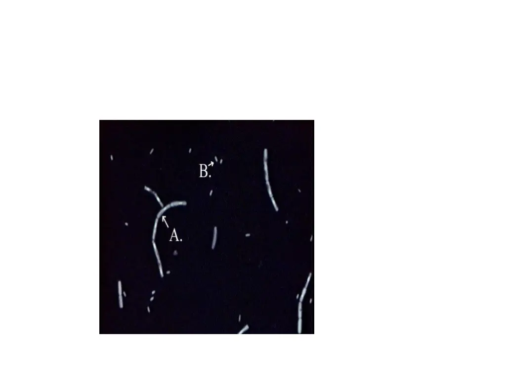 nnegaegatively stained bacillus a vegetative cell