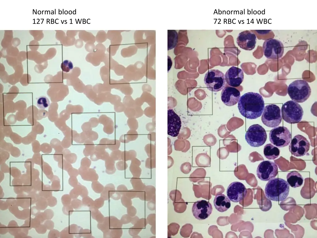 normal blood 127 rbc vs 1 wbc
