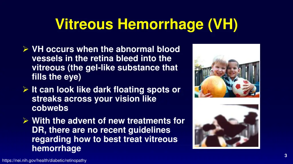 vitreous hemorrhage vh