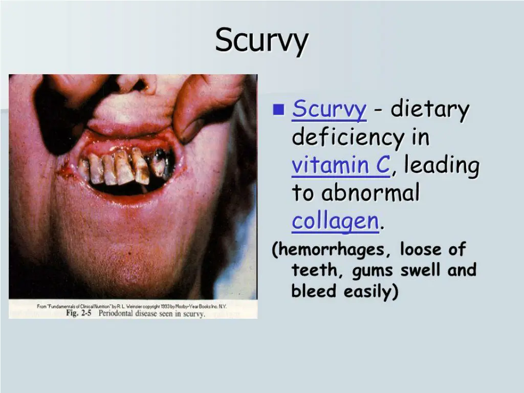 slide18