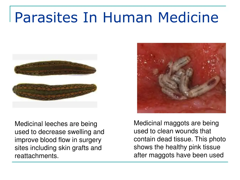 parasites in human medicine