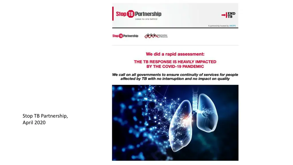 stop tb partnership april 2020