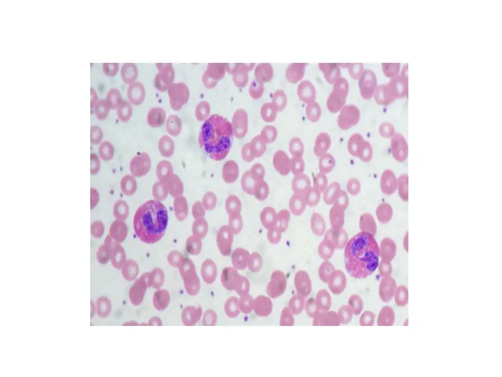 slide8