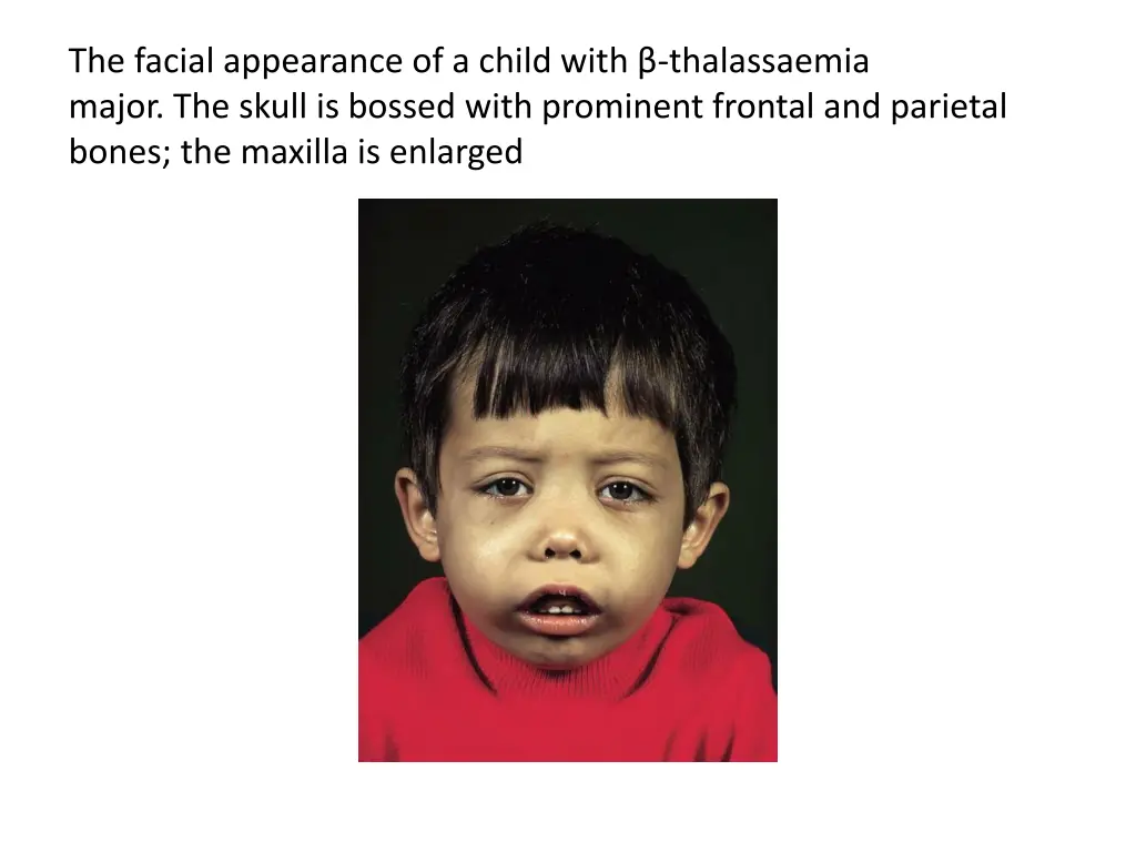 the facial appearance of a child with