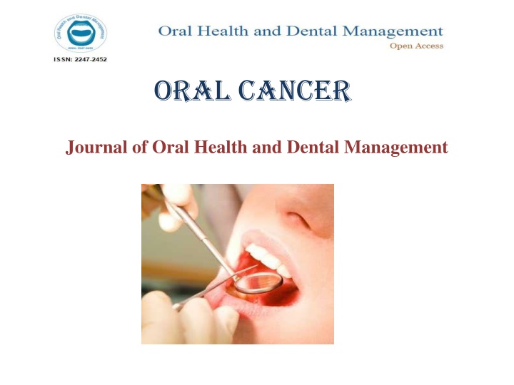 oral cancer
