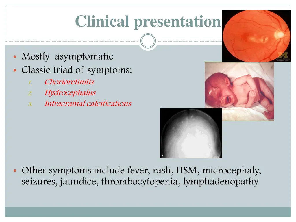 clinical presentation