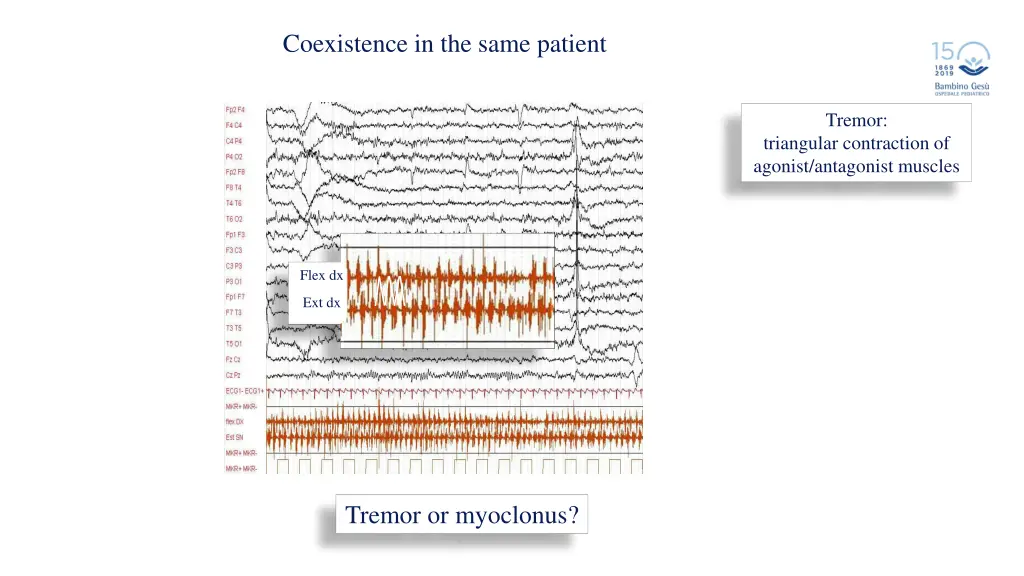 coexistence in the same patient 1