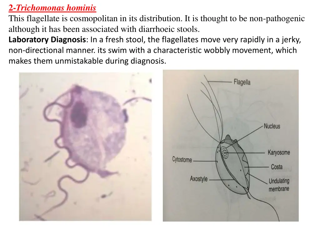 2 trichomonas hominis this flagellate