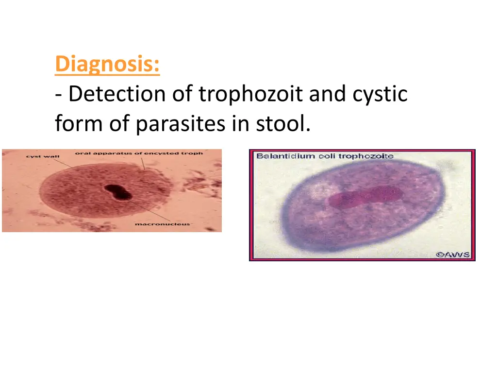 diagnosis detection of trophozoit and cystic form