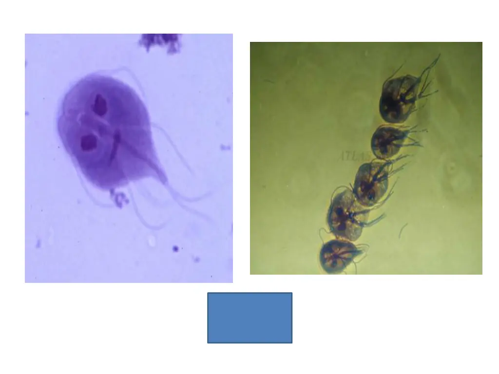 http fcmdsc files wordpress com 2010 04 giardia