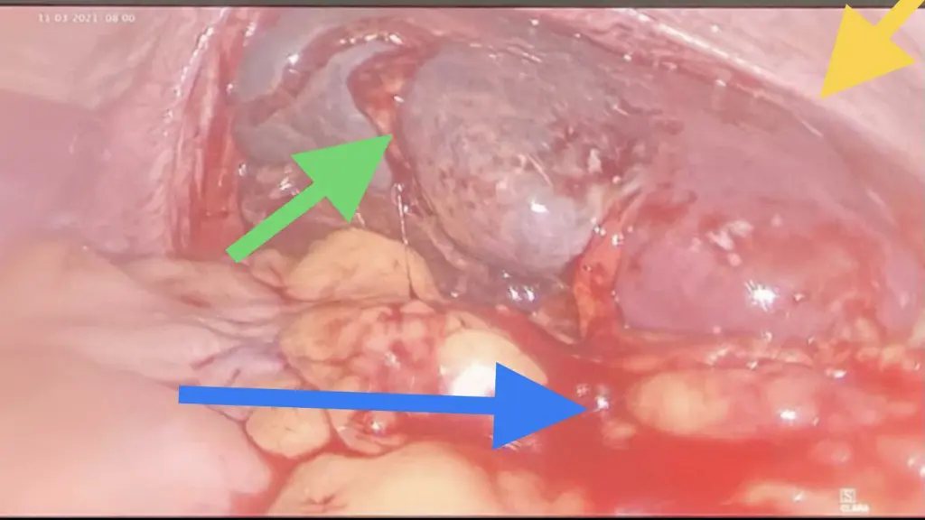 slide12