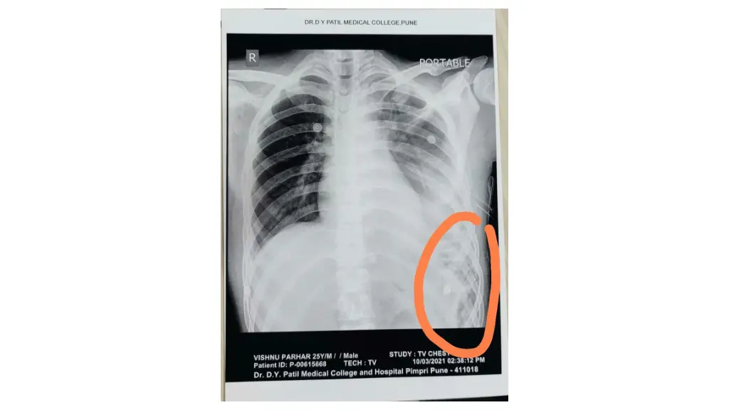 slide8