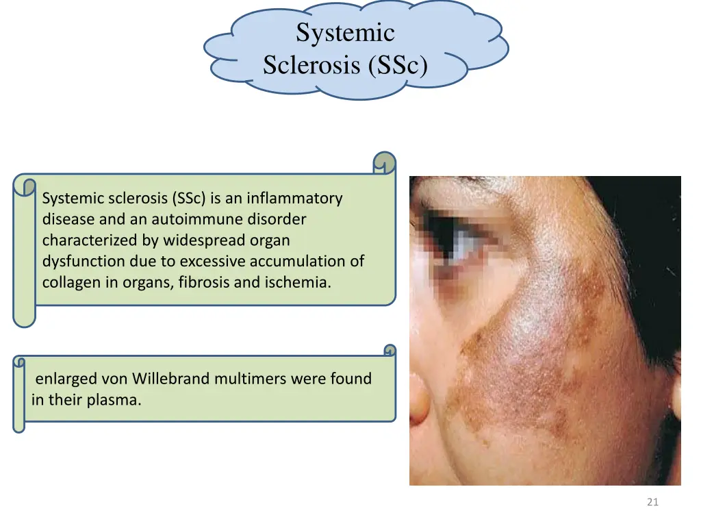 systemic sclerosis ssc
