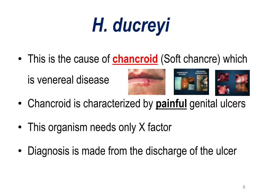h ducreyi