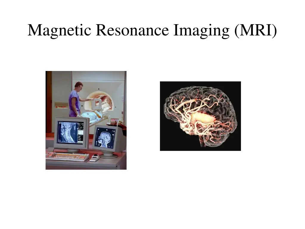 magnetic resonance imaging mri