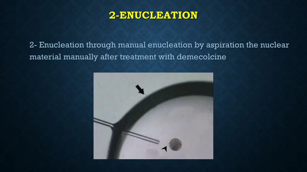 2 enucleation 1
