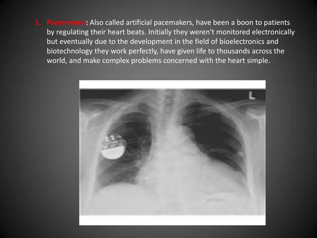 1 pacemakers also called artificial pacemakers