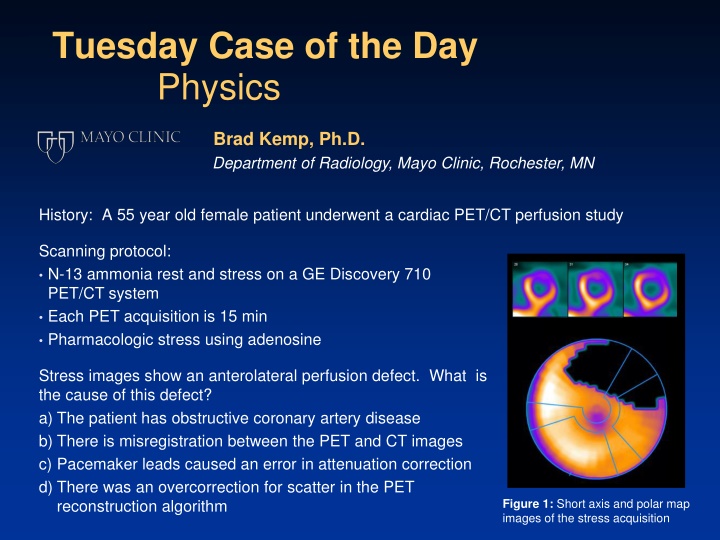 tuesday case of the day physics