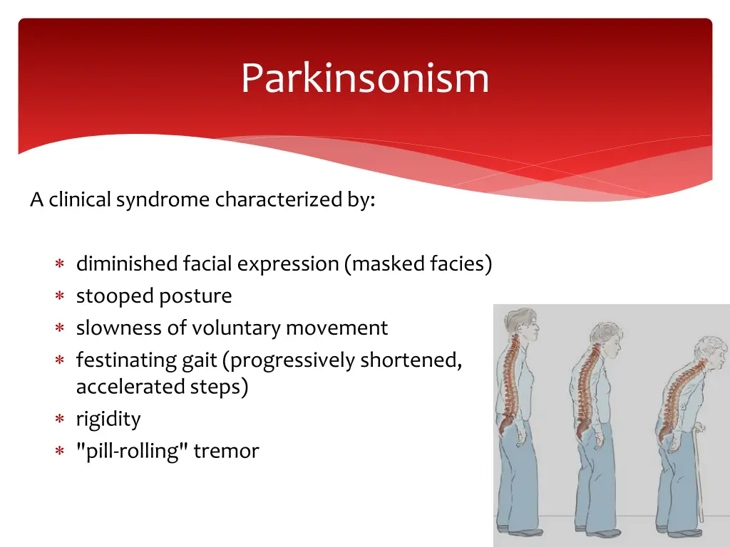 parkinsonism