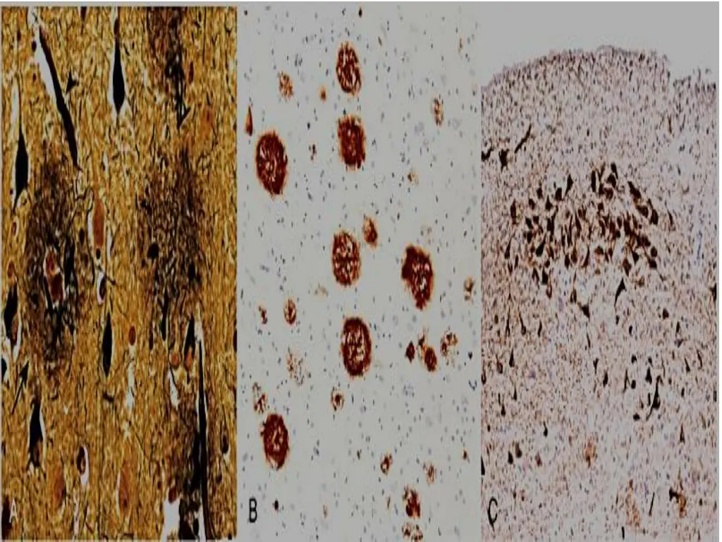 slide22