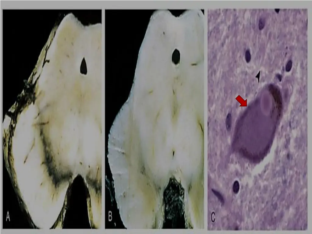 slide35