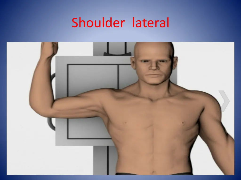 shoulder lateral