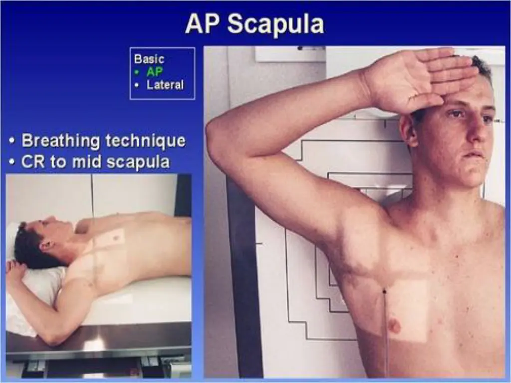 slide15