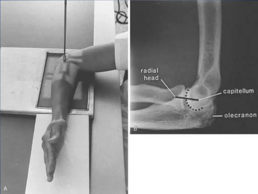 slide4