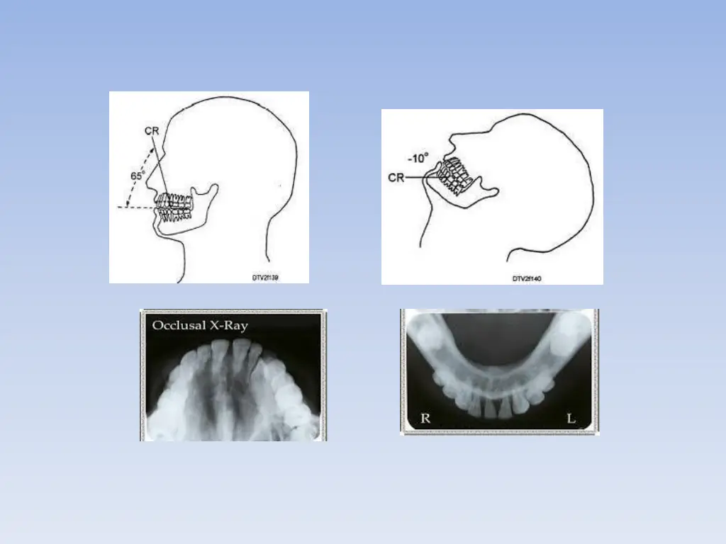 slide24
