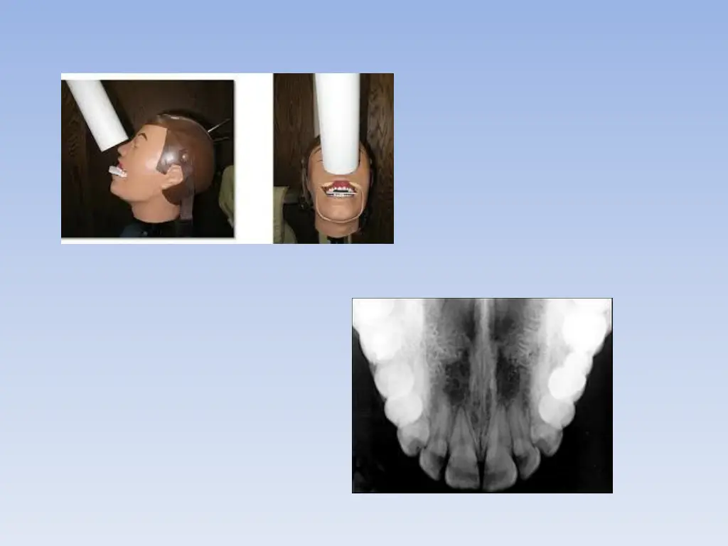 slide26