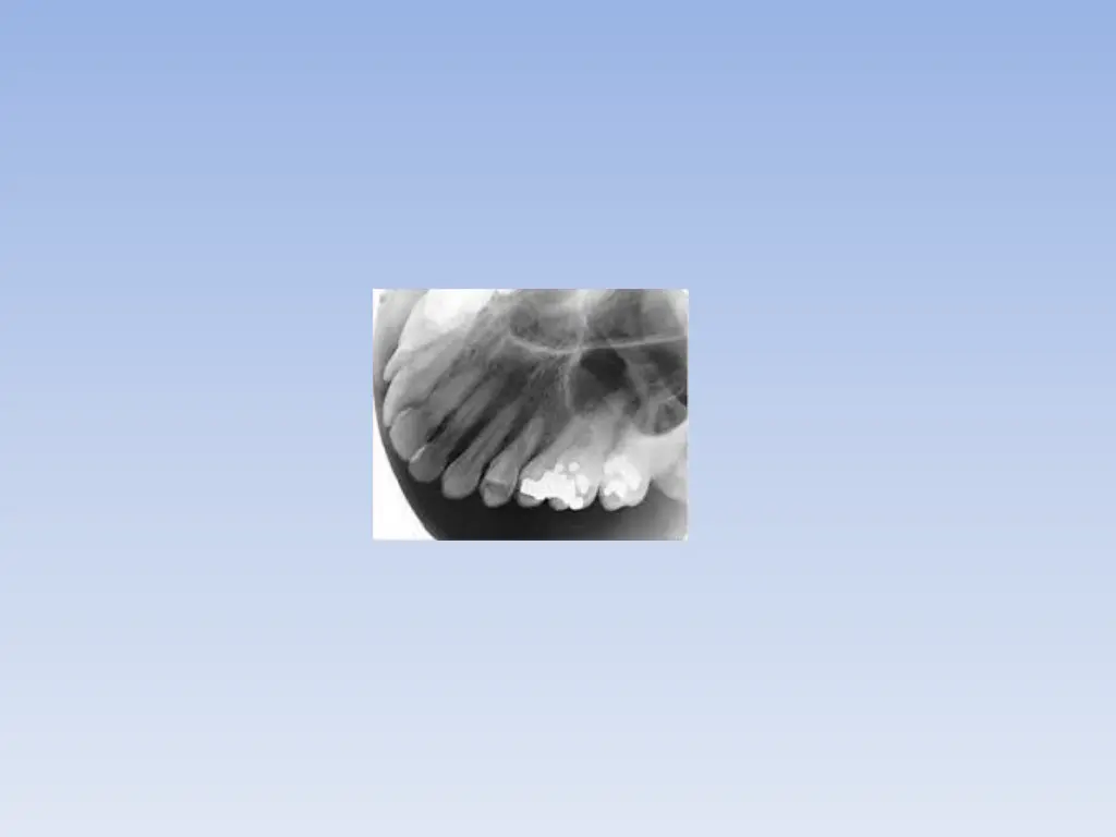 slide30