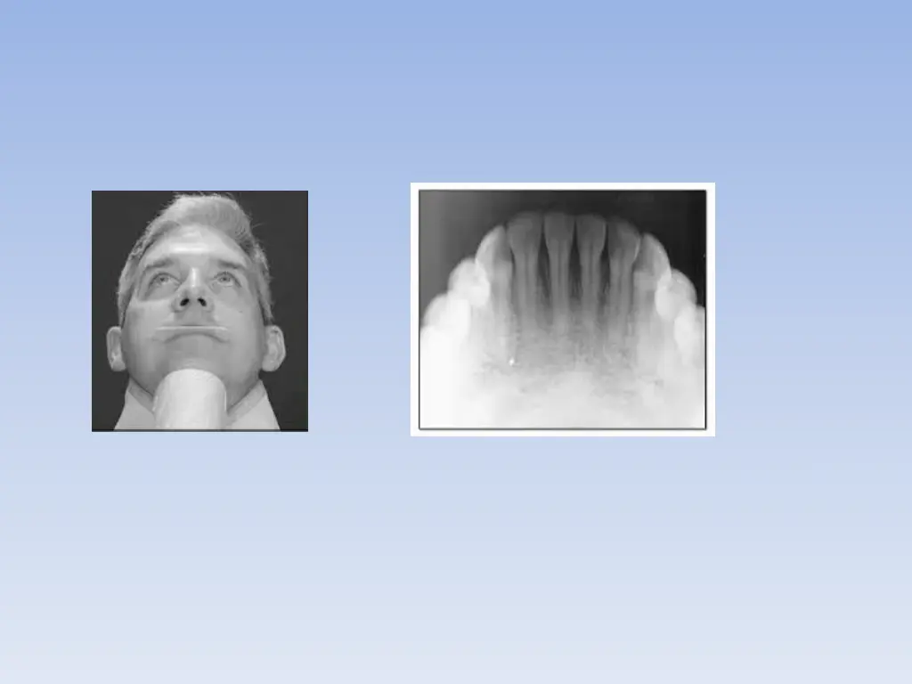 slide32