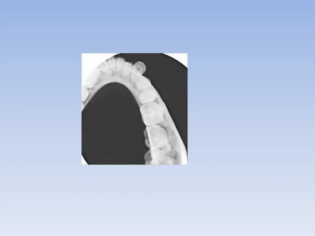 slide36