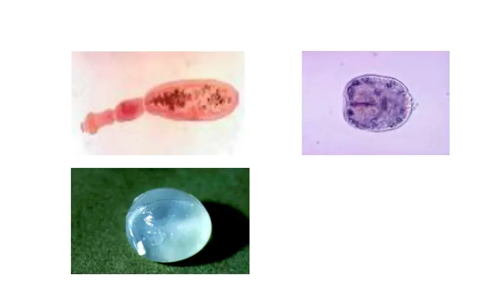 description description echinococcus granulosus