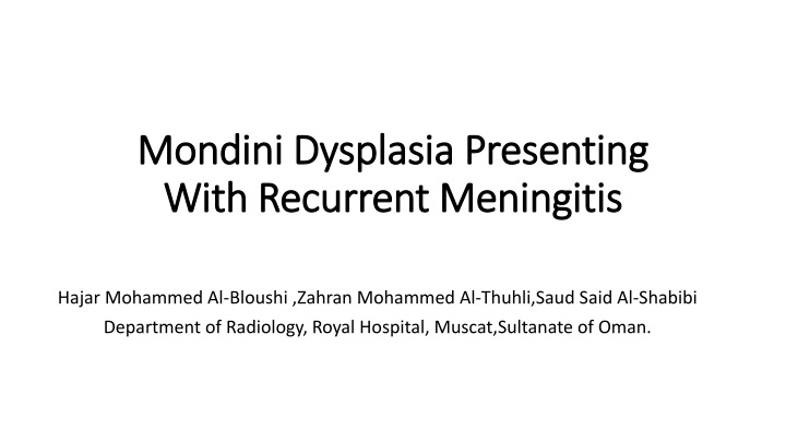 mondini dysplasia presenting mondini dysplasia