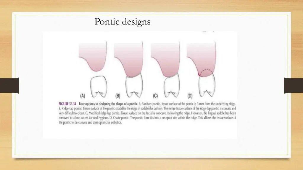 pontic designs