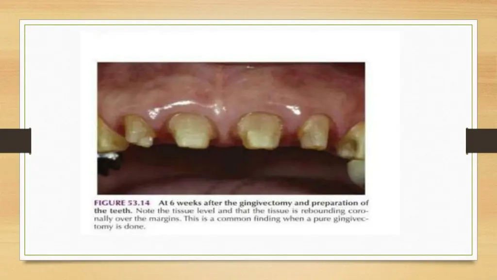 slide17