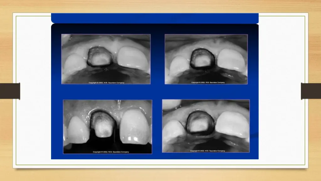 slide21