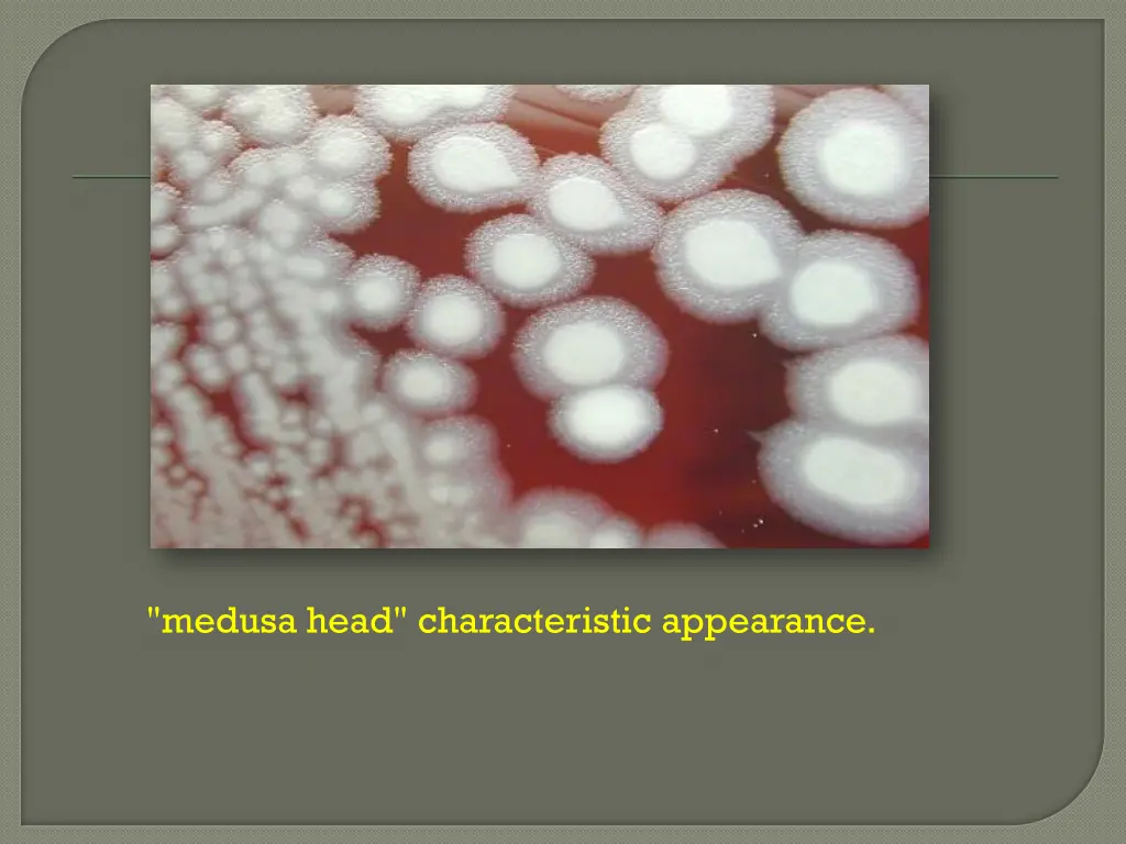 medusa head characteristic appearance