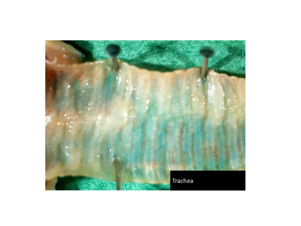 slide15