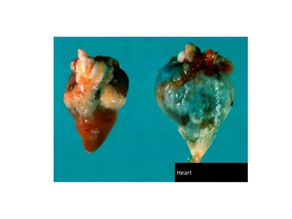 slide18