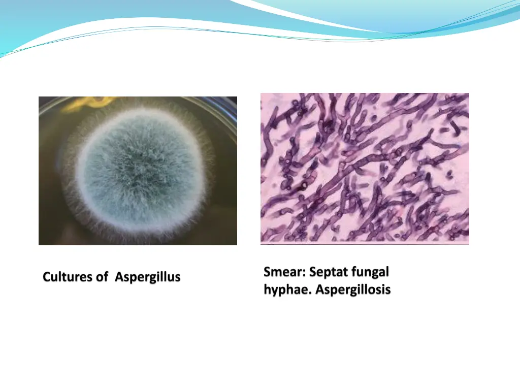 slide16