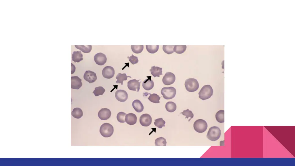 slide19