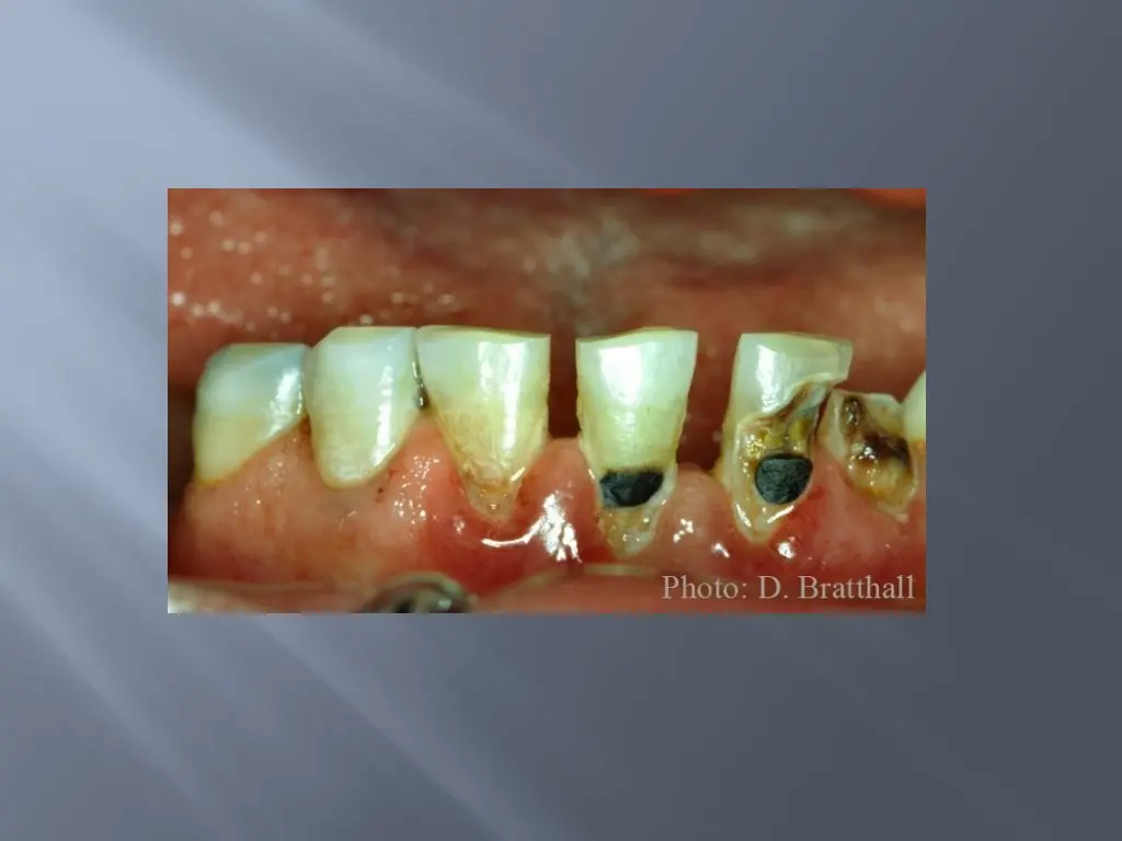 slide5