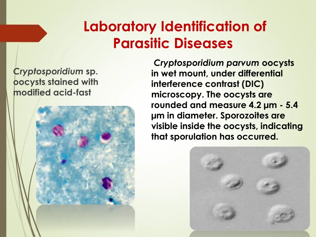 laboratory identification of parasitic diseases