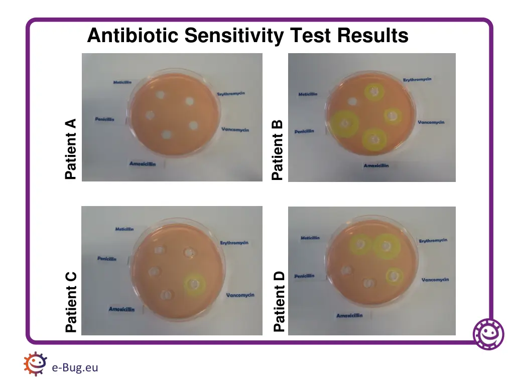 antibiotic sensitivity test results