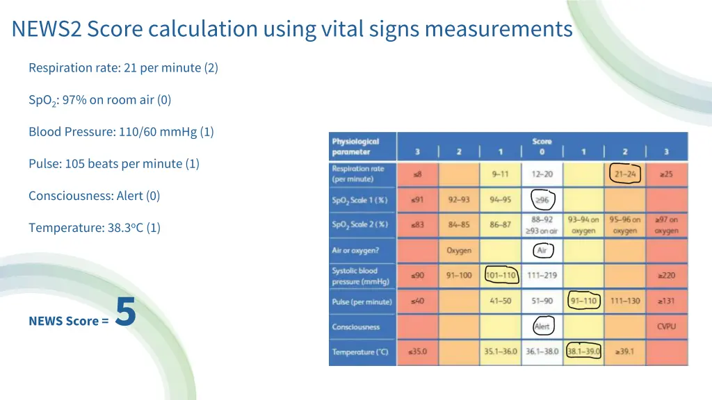 news2 score calculation using vital signs