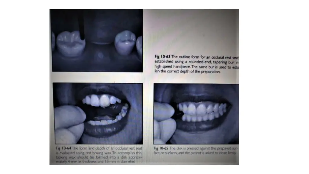 slide10