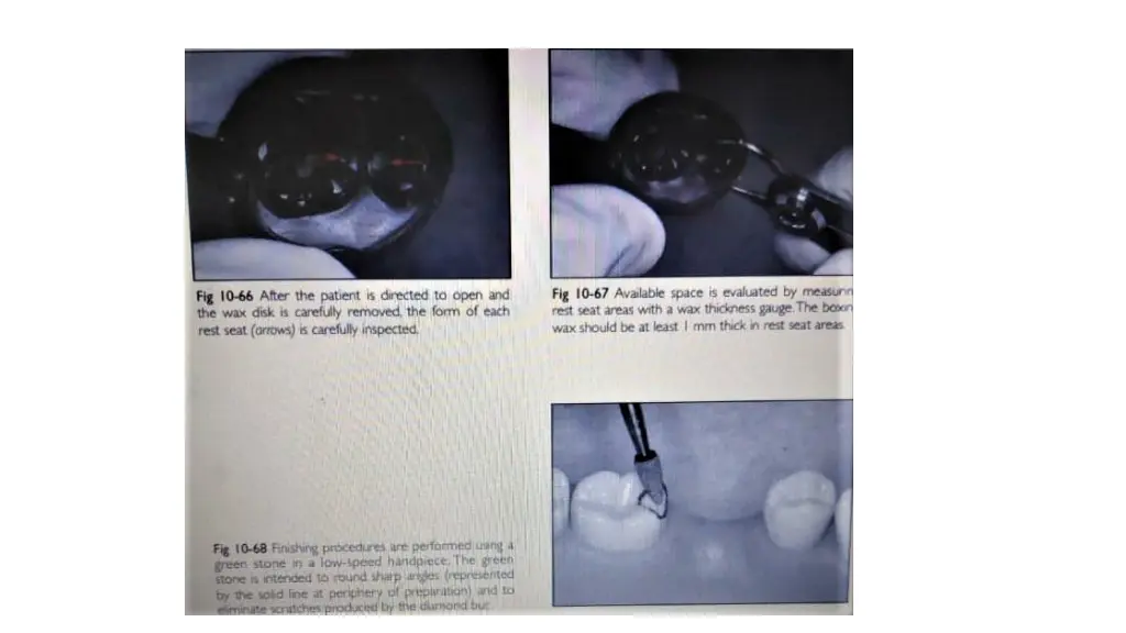 slide11